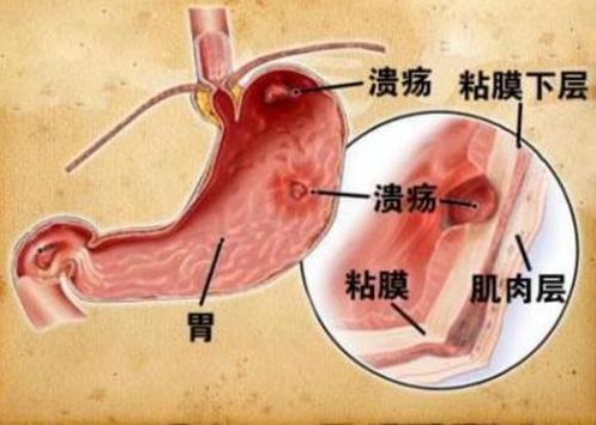 无痛胃镜多少钱？上海各家医院做胃镜收费标准