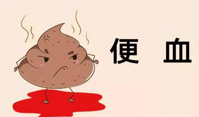男人大便出血严重吗