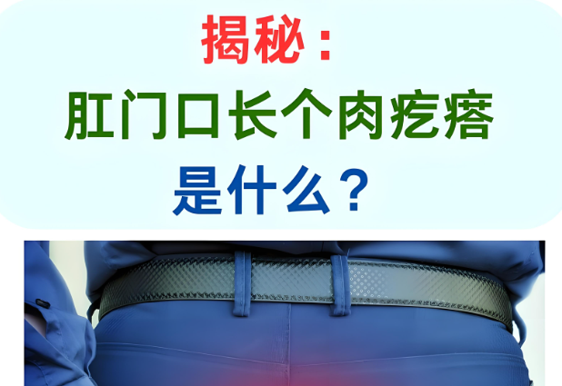 肛门长包禁忌人群