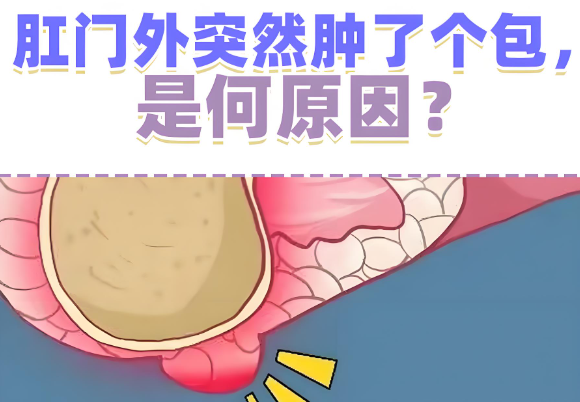 肛门长包手术伴随风险