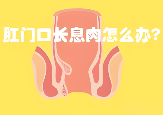肛门息肉手术后注意事项