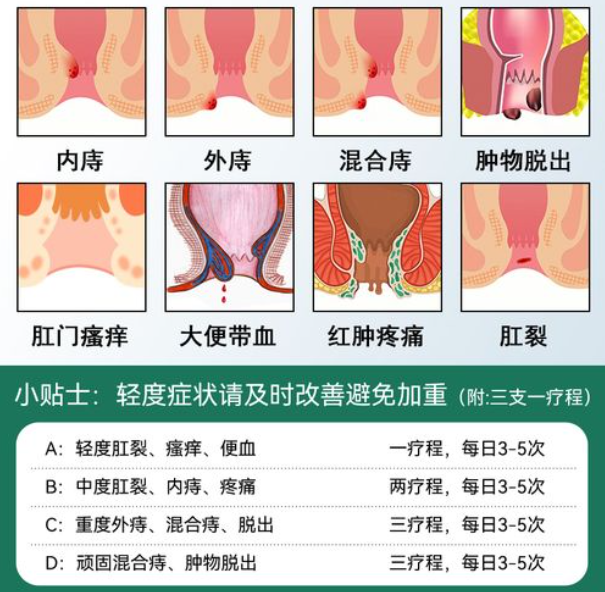 痔疮喷血怎么处理