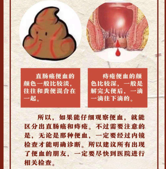 消化道出血会引起大便出血吗？
