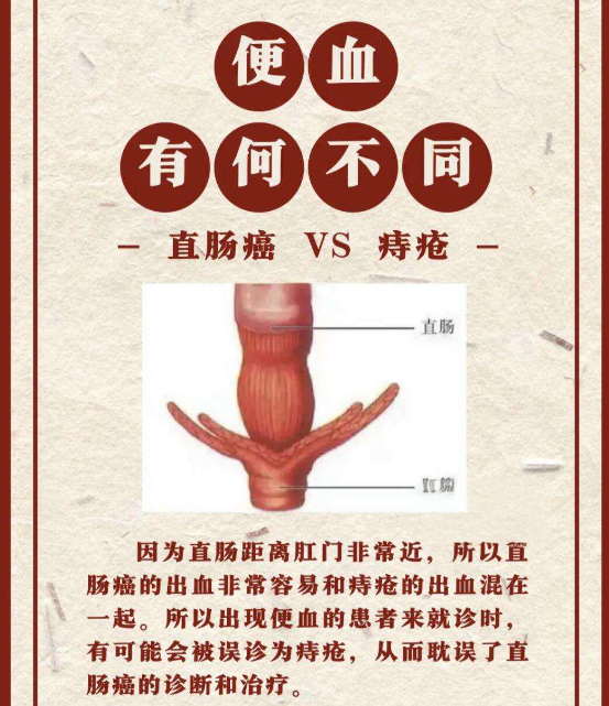 腹部超声能检查出大便出血的病因吗？