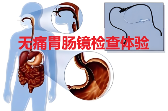 哪些情况下可以选择无痛胃镜以外的检查方法？