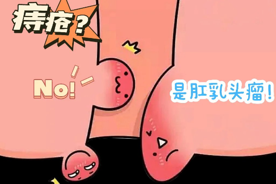 高血压患者与肛乳头瘤有何关系？