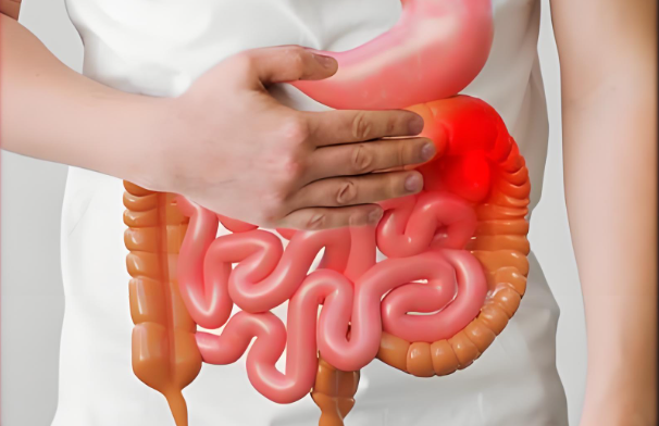肠炎与食物中毒有什么区别？