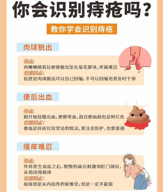 痔疮需要做哪些检查？