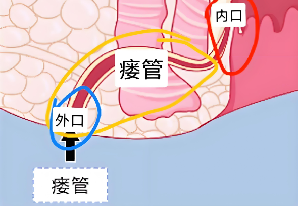肛瘘手术后可以运动吗？